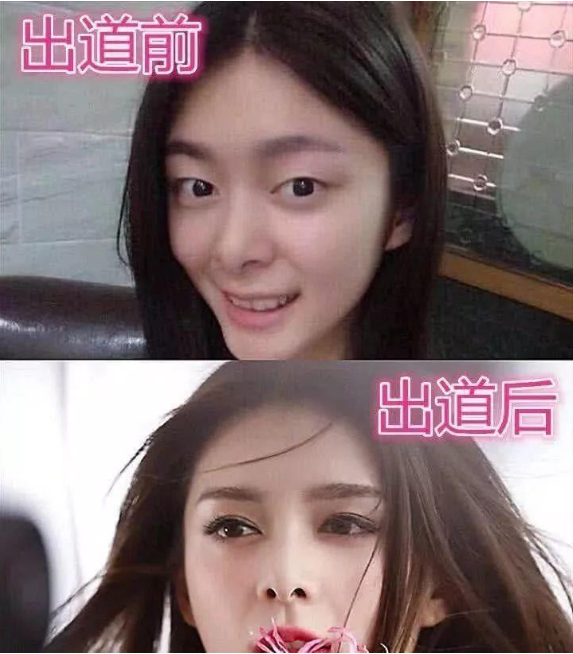 艺人出道前vs出道后,傅菁单眼皮变双眼皮,看到吴宣仪