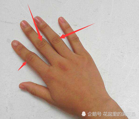 肝不好的人,手上3个"暗示"很明显,拖久肝癌可能"触机便发"