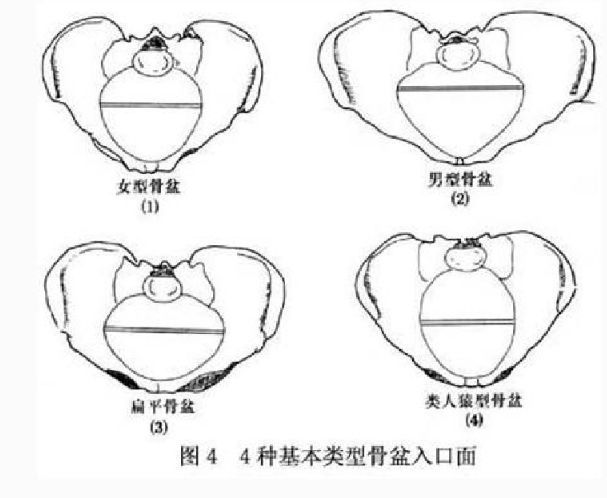 分为三个平面:入口平面,中骨盆平面,出口平面. 1 入口平面 横椭圆形.