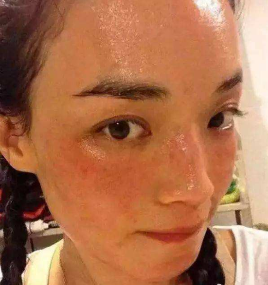 女生总"满脸油光"?教你3妙招,摆脱油腻,做个"清爽"小仙女