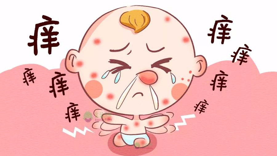 宝宝长了汗疱疹该怎办?