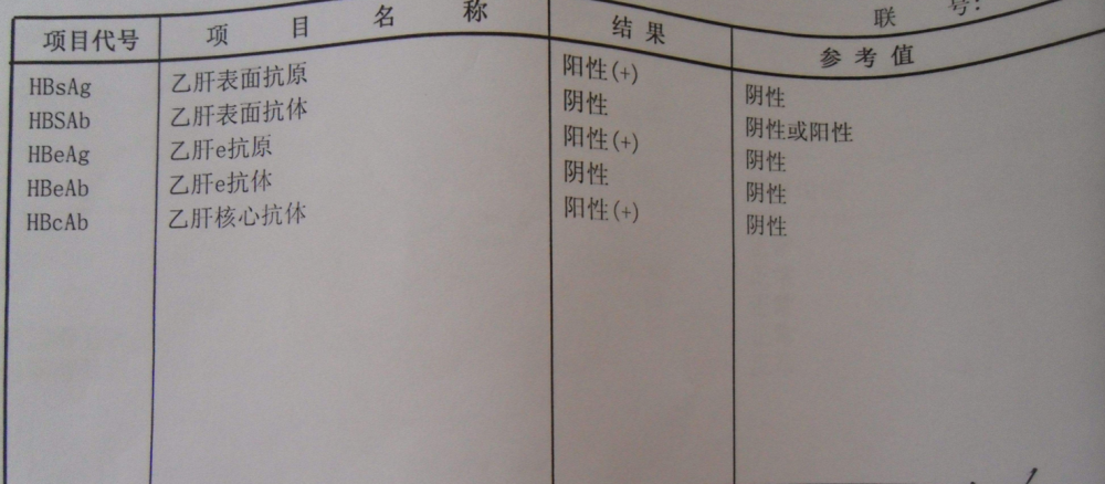 乙肝dna阳性,其他指标正常,这种大三阳说明什么?