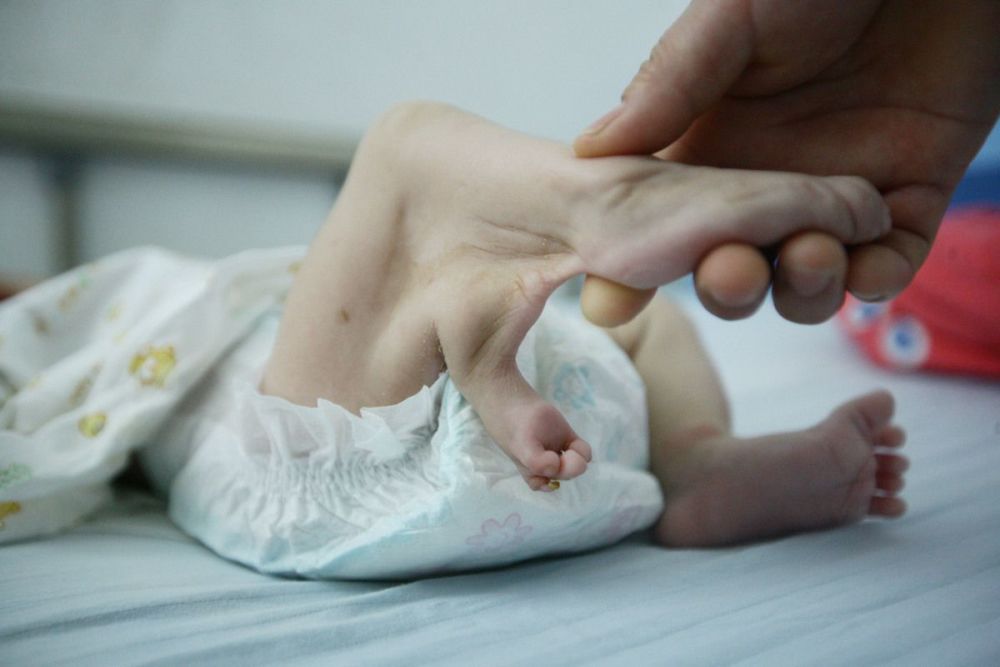 月表妹做产检的时候查出孩子的四肢发育不完整,生下来可能会有些畸形