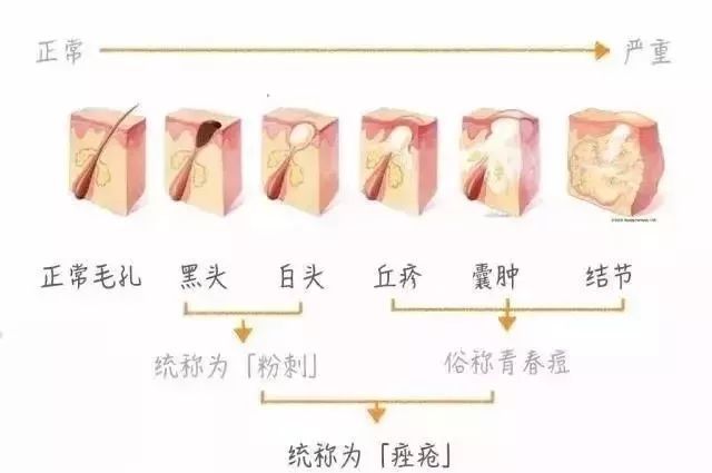 毛孔堵塞,皮肤油脂分泌