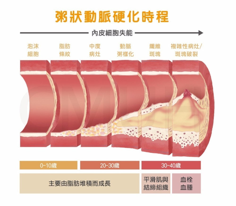 血管硬化,血管,动脉硬化,血脂,肥胖,吸烟