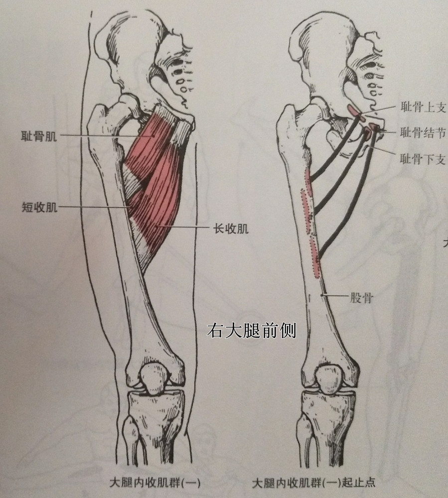 紧张,缩短肌肉: 大腿内收肌:x腿股骨会过于内收,从而缩短内收肌群