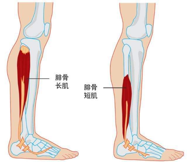 膝关节,肌肉,髂胫束,大腿,x型腿