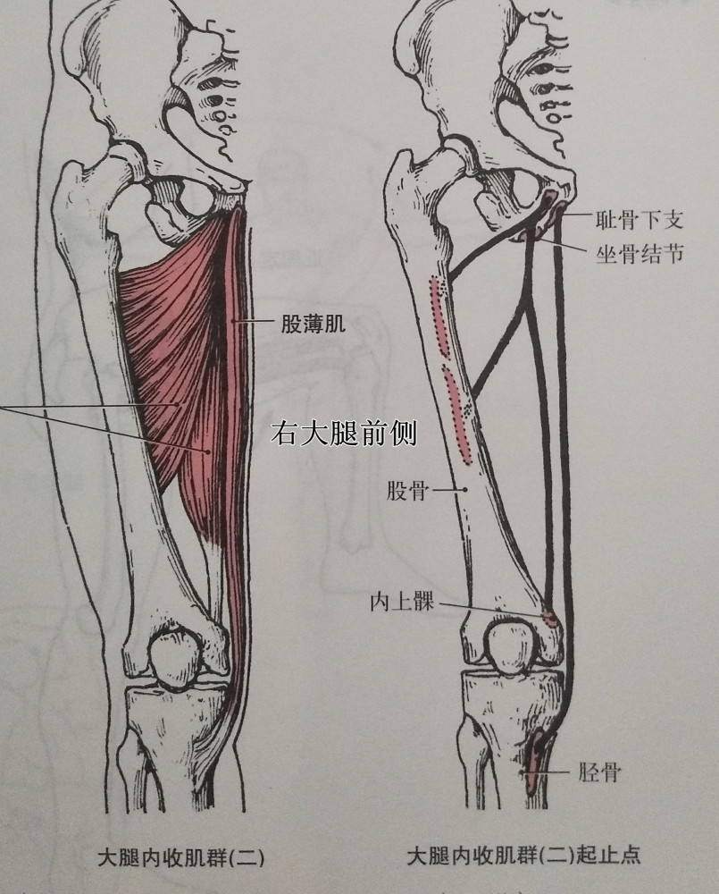 膝关节,肌肉,髂胫束,大腿,x型腿