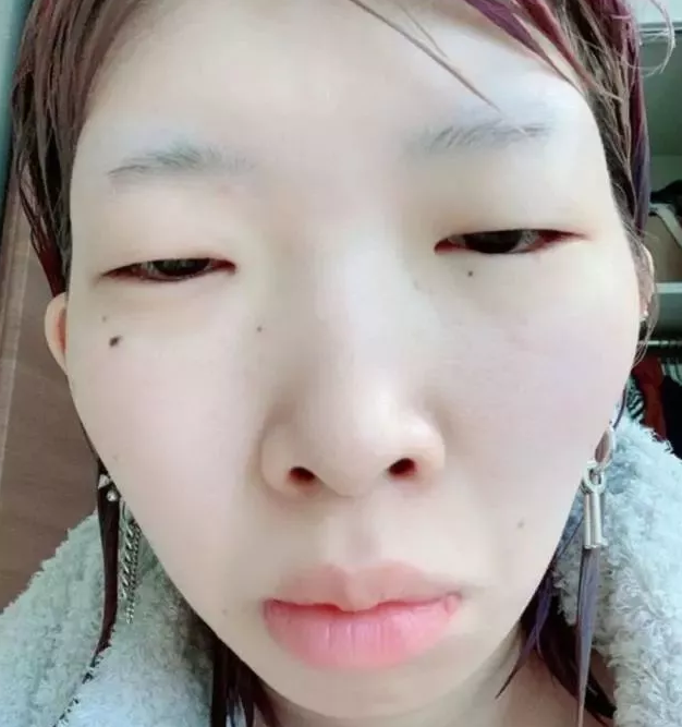她是"日版乔碧萝",去掉美颜滤镜眼睛消失,成超级丑女