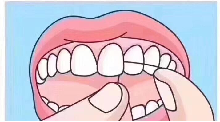 补完牙齿多久能吃东西?补牙后要怎样保养牙齿?一起了解一下吧