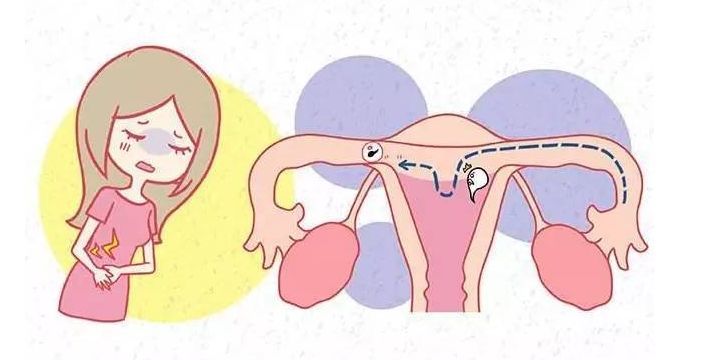 宫腔灌注对内膜的好处图片