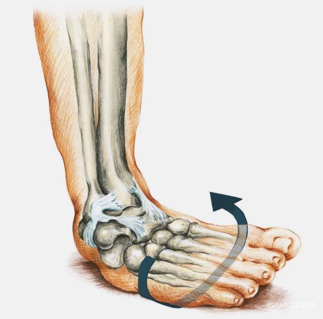 踝关节扭伤:习惯性崴脚不是"点背",这样治疗才能不伤"