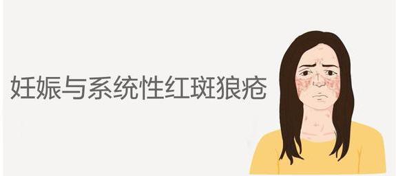 风湿免疫科医生:患有系统性红斑狼疮的孕妈们应该注意