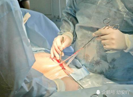 医生:别超过"这个数",贼