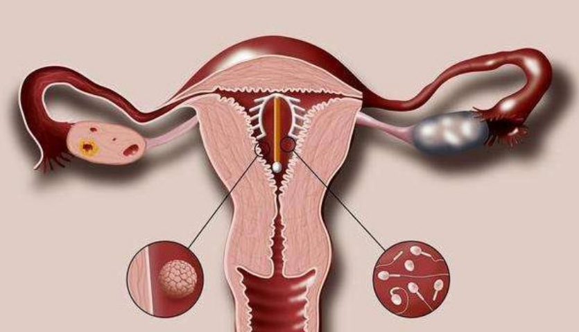 女性为生二胎取环,上环对身体伤害有2,科学避孕方式了解下?