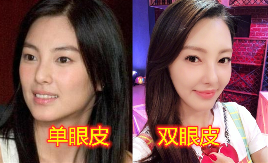 明星割双眼皮前vs后,扛住了戚薇和秦海璐,而张雨绮变化大!