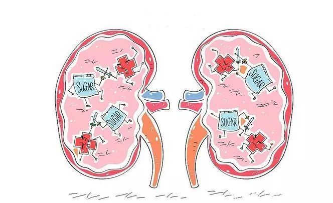 壁虎医生:肾移植手术后的管理与监测,应做到哪些才算合格?