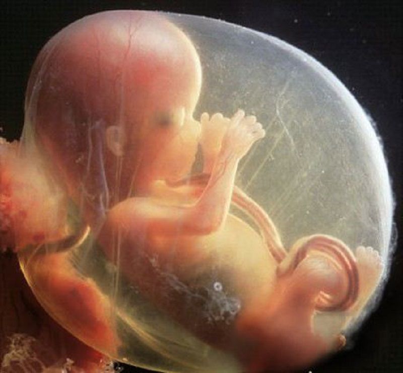 胎儿总在妈妈肚子里做这些"坏事"?孕妈不要着急,这是正常现象