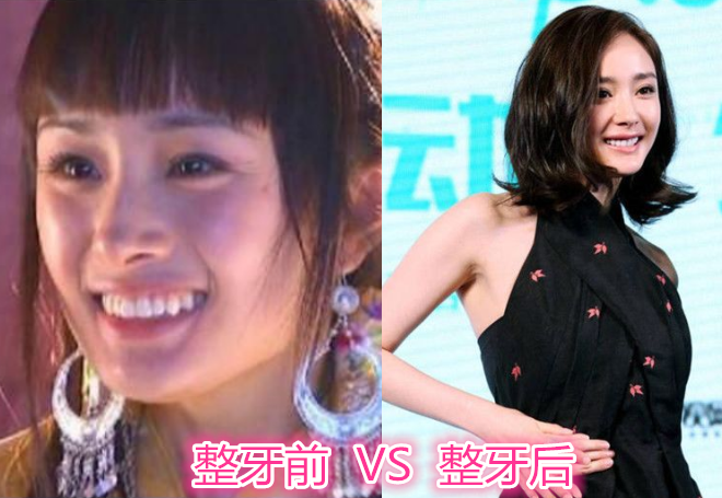 女星整牙前vs后,baby成女神,唐嫣有气质,看到杨紫:哦买噶的