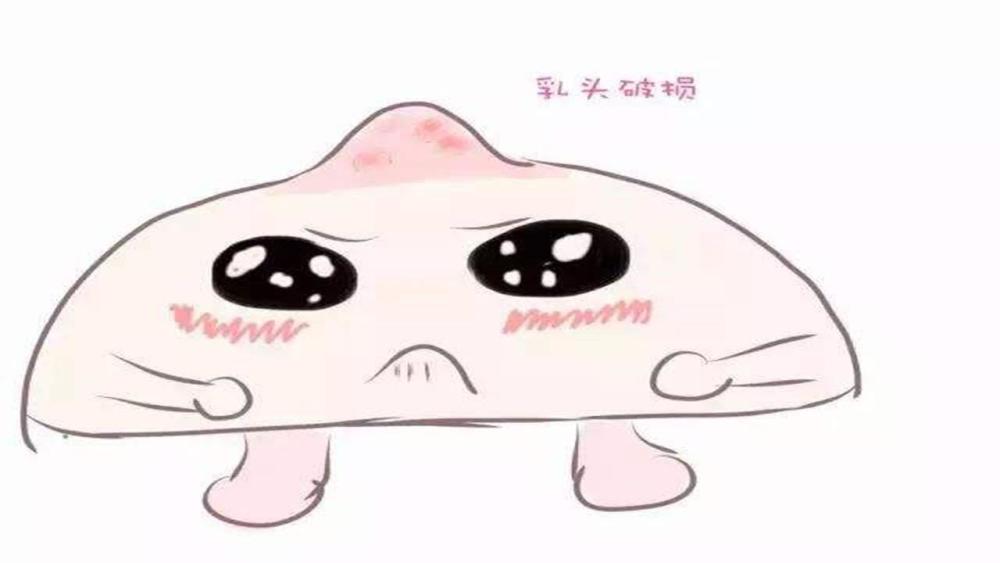 宝宝,乳头,宝妈,医生,乳头皲裂,喂奶