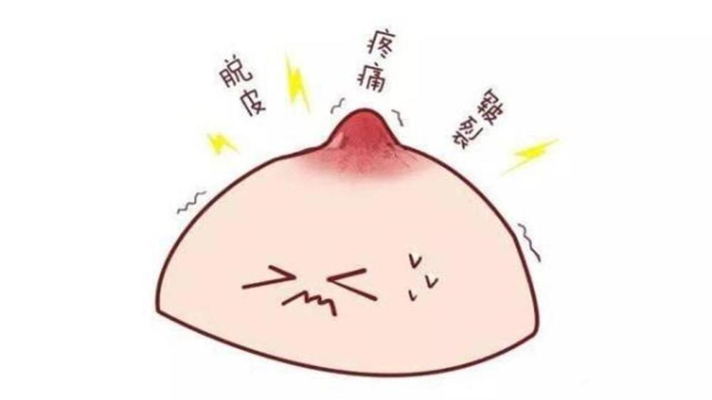 宝宝,乳头,宝妈,医生,乳头皲裂,喂奶