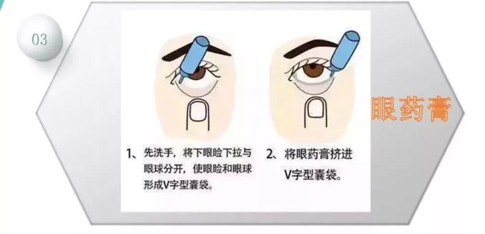 眼药水用这么久,你滴对了么?