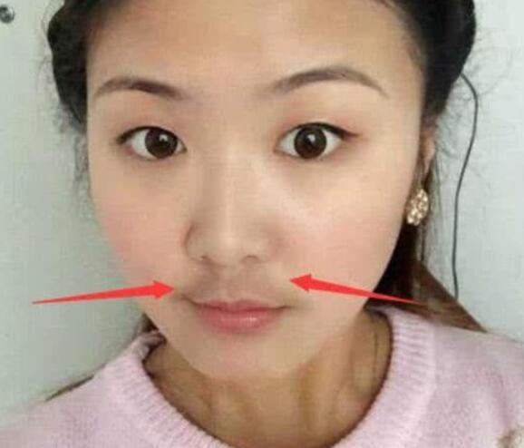 其实不然,经常性的抿嘴唇会让唇部周围的黑色色素沉淀,久而久之在视觉