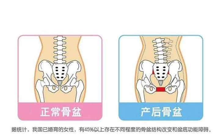 剖腹产后体型会比顺产好吗?产后收腹工作到位,身材恢复又快又好