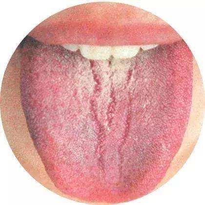 血虚不润,脾虚湿浸,素体阴虚…均可致舌苔