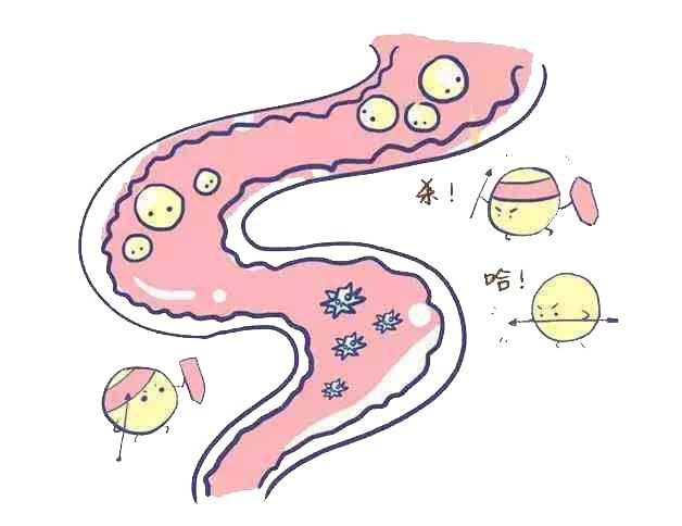 揭秘"伪装者"——胃食管反流