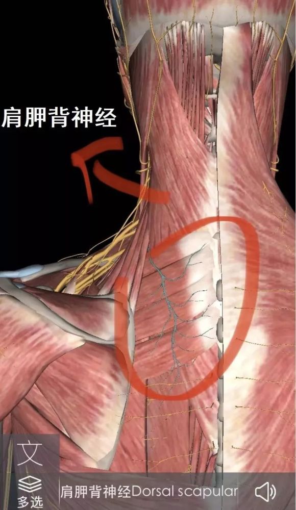 扎肩胛背神经治疗肩胛缝酸痛