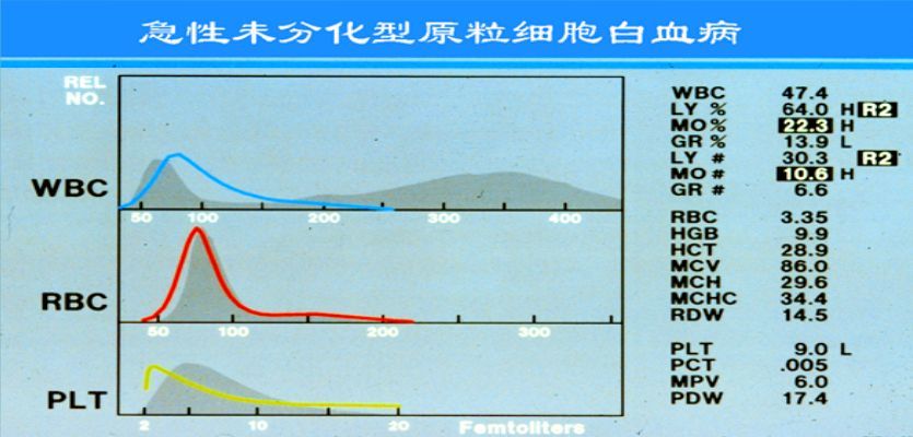 红细胞直方图