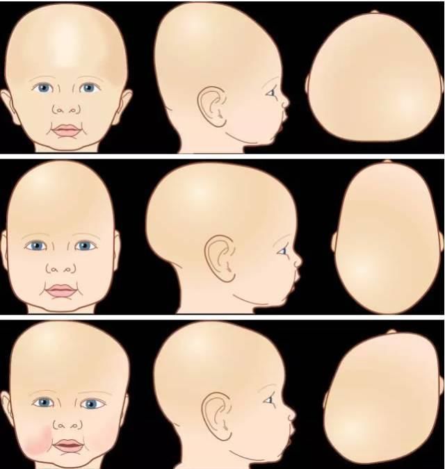 宝宝头型塑造有2个关键期,家长别错过,不然五官再好看
