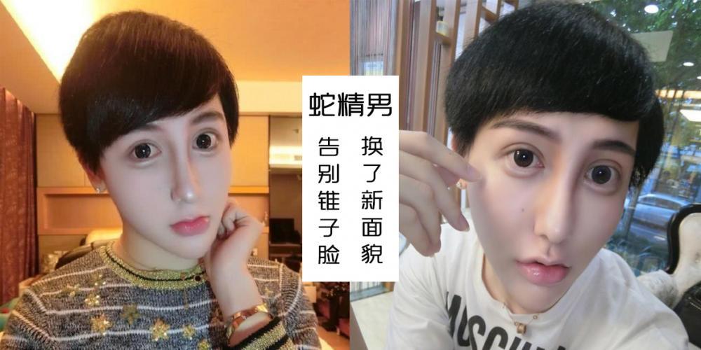 大家还记得"蛇精男"?如今的他告别锥子脸,样子也变得自然顺眼