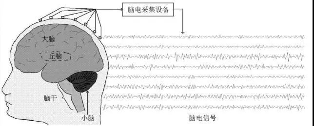 称之为脑电波(electroencephalogram,eeg),其示意图如下