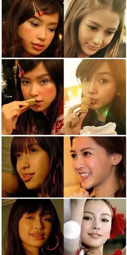 丑女逆袭,整容成电视剧女王,如今崩成僵尸脸,比baby还