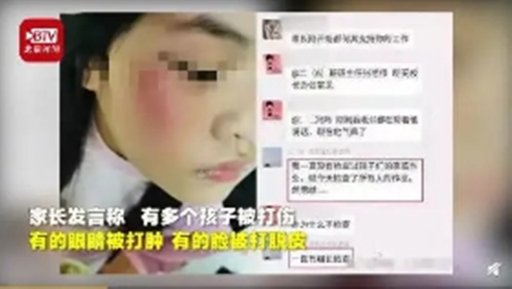 多名小学生被老师打肿眼睛,脸被打脱皮,班主任反呛:来