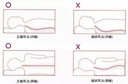 注意坐姿站姿睡姿,维持颈椎,胸椎正常生理曲度.