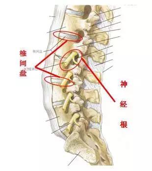 腰腿痛,椎间盘,腰椎间盘突出症,腰椎间盘,腰椎