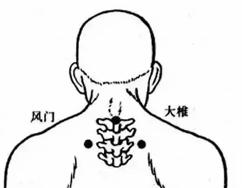 就是我们后脑勺到后背上部的这些风字头的大穴:风池,风府,风门.