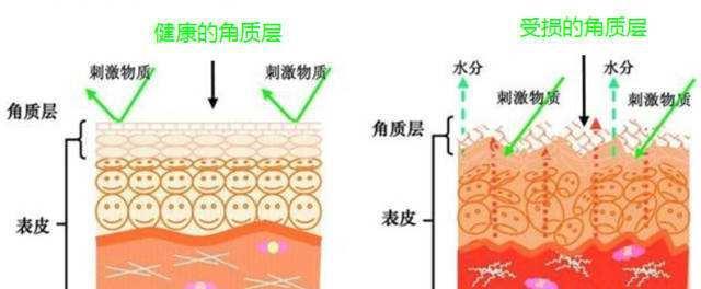 角质层过薄皮肤泛红怎么办?护肤医生给出解决方法,终身受用!