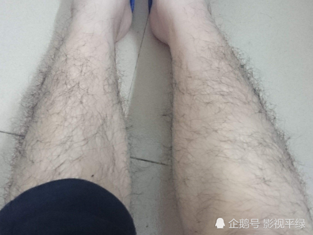 为什么有的人腿毛旺盛,有的人却"光溜溜"?这3个原因不