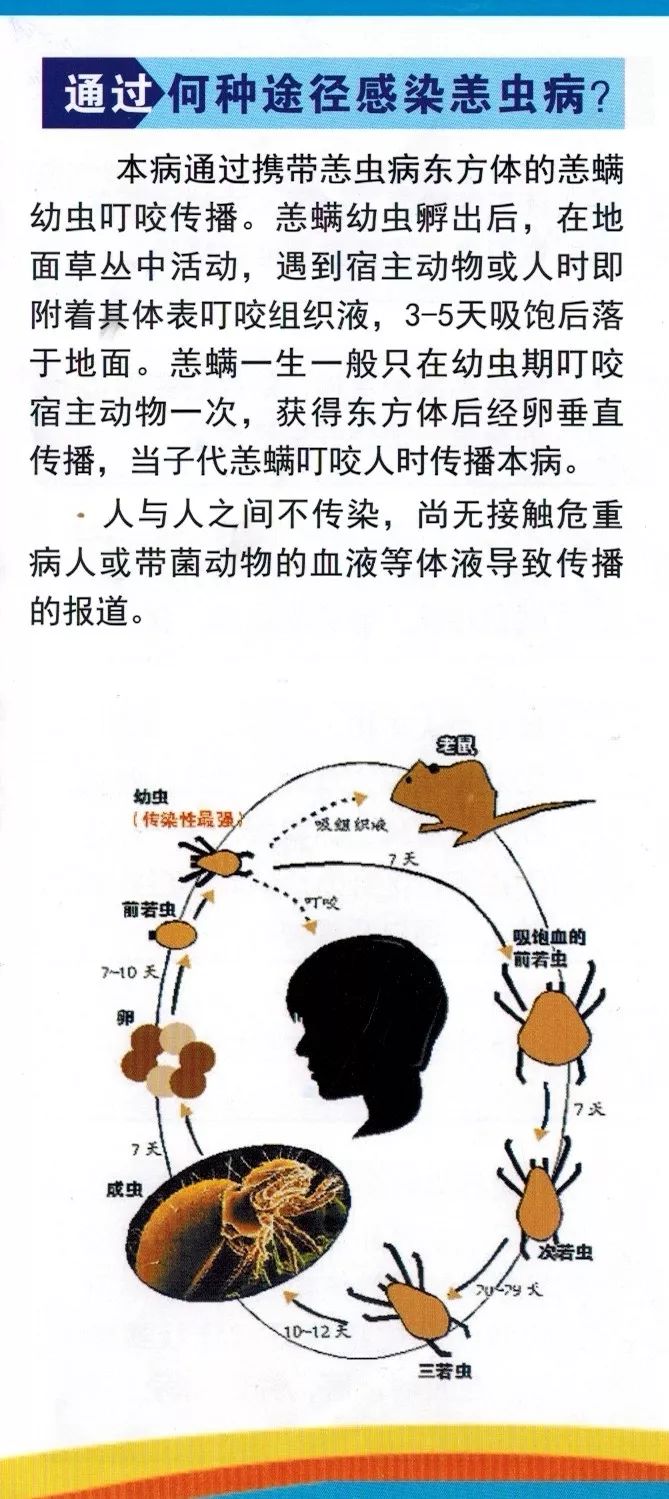 恙虫病,立克次体,症状,上蔡县