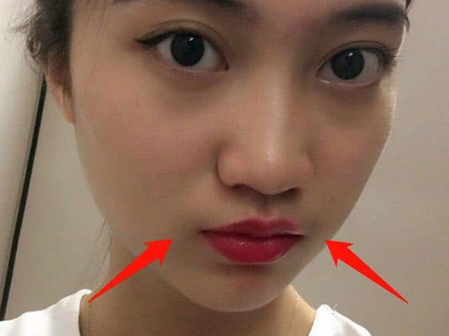 为何有些女生的嘴唇上会长出"胡子"?无非是这3点原因作怪,别忽视