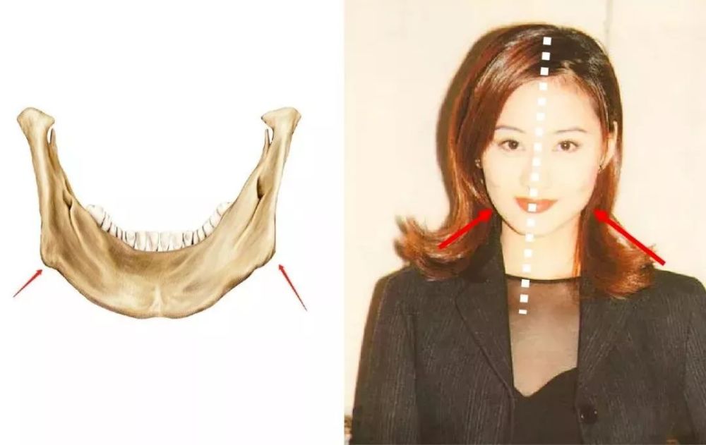 左右脸完全不对称,郑爽现在的面相预示着什么?