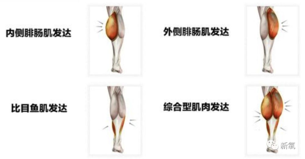 而浅层的肌肉——腓肠肌肥厚是造成小腿粗壮, 肌肉轮廓明显的主要原因