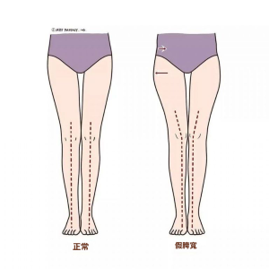 一星期臀围减3cm 懒人必看:5个睡前运动 改善假胯宽,扁平屁股