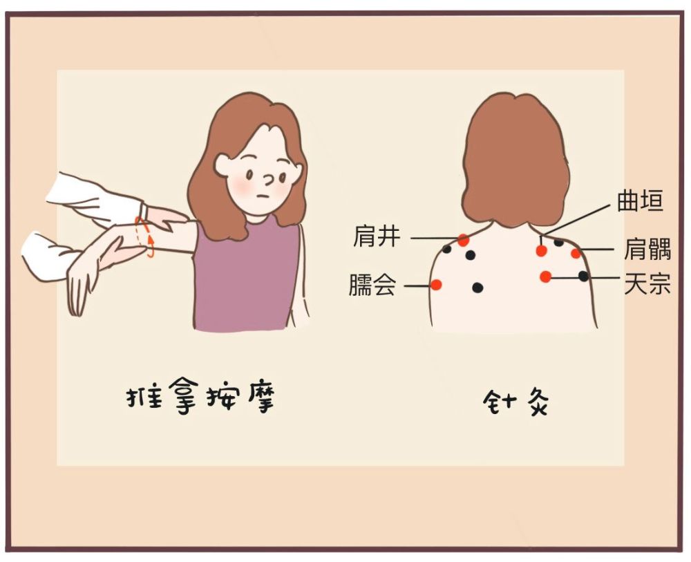 医生:这种情况也极易导致肩痛