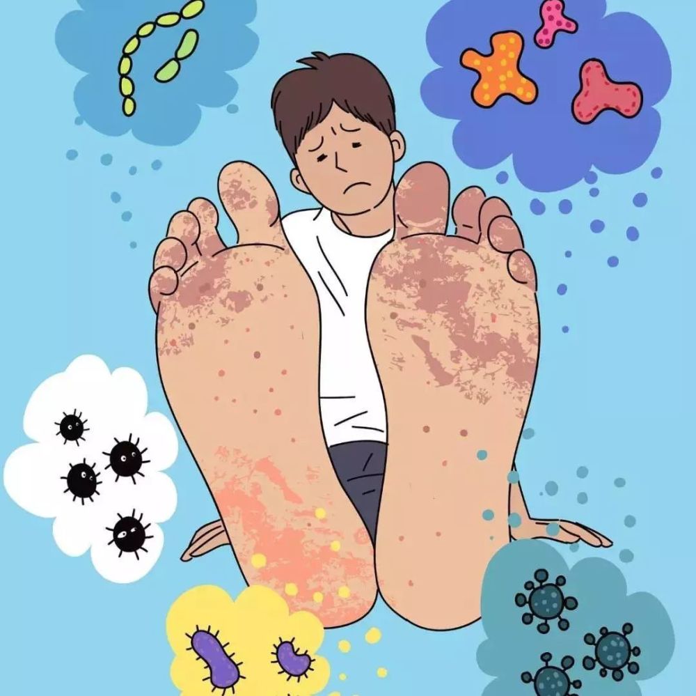交大二附院皮肤科专家:别拿手足癣不当回事