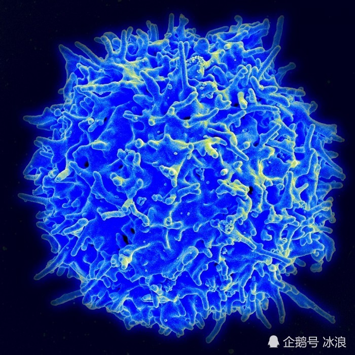研究小组认为,当受体与特定的抗原结合时,cd4 阳性杀伤性 t 细胞就会